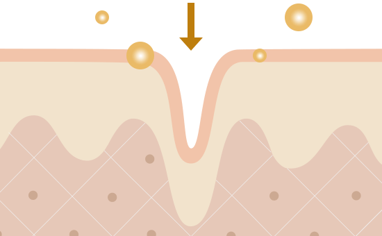 肌図